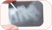Endodontics