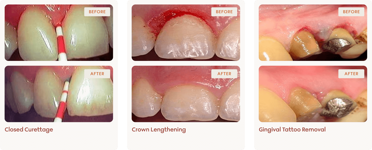 Clinical results 1