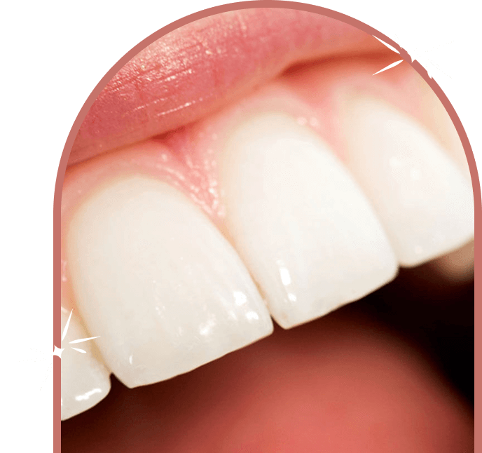 Conservative Dentistry at the Smile Architect
