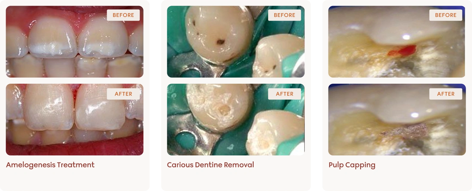 Conservative dentistry clinical results 1