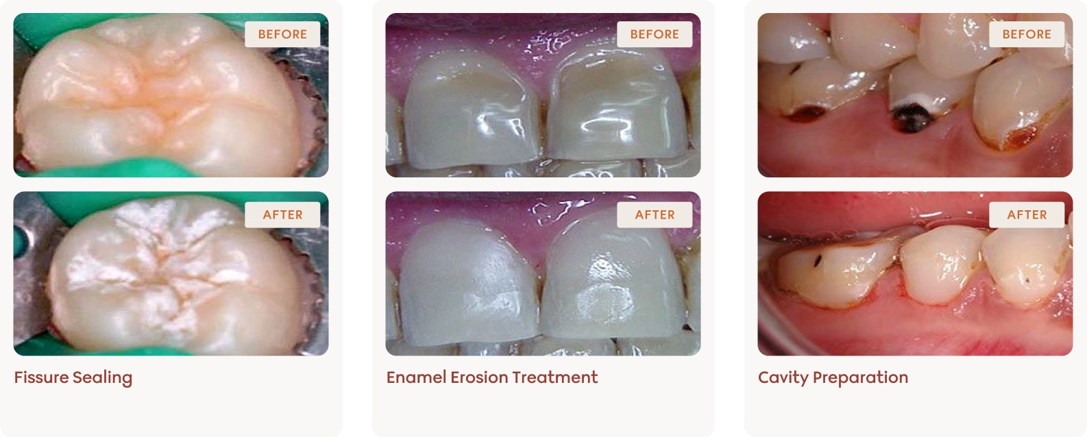 Conservative dentistry clinical results 2