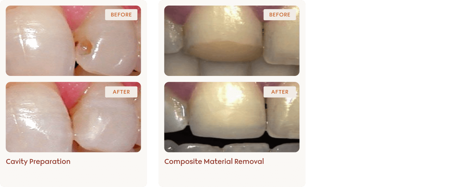 Conservative dentistry clinical results 3