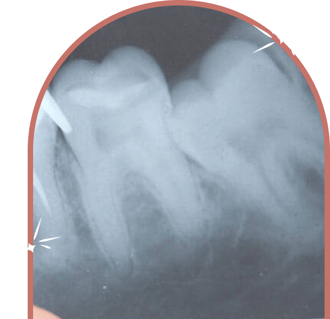 Endodontics