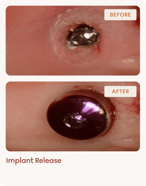Implantology-img-3 (1)