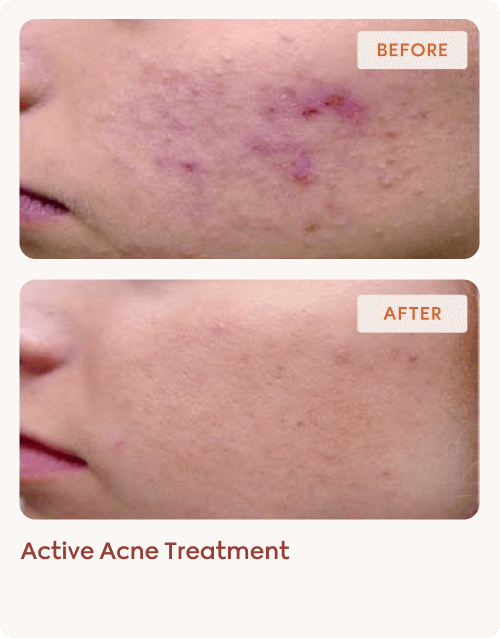 clinical-results-img-5 (1)